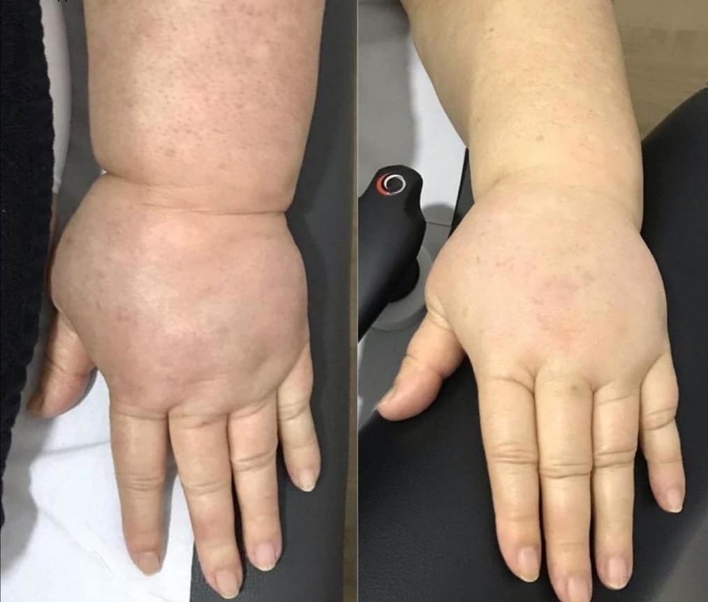 Clinical Case 2